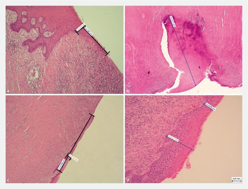 https://cdn.ncbi.nlm.nih.gov/pmc/blobs/309f/7581471/76f3262c8180/10-1055-a-1261-3103-i1790ei8.jpg