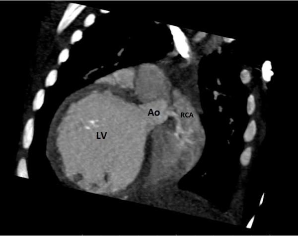 https://cdn.ncbi.nlm.nih.gov/pmc/blobs/30a3/4086689/430aa981dd1e/1752-1947-8-170-4.jpg