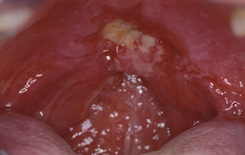 https://cdn.ncbi.nlm.nih.gov/pmc/blobs/30a4/9988275/b339bddb1e86/gox-11-e4868-g001.jpg