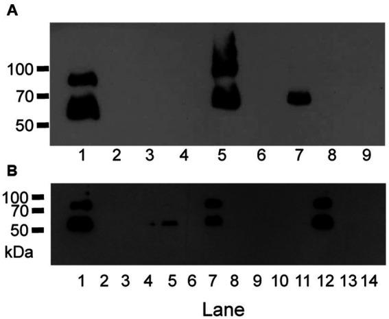 https://cdn.ncbi.nlm.nih.gov/pmc/blobs/30aa/10330708/c1ec5a68e859/fmicb-14-1212149-g001.jpg