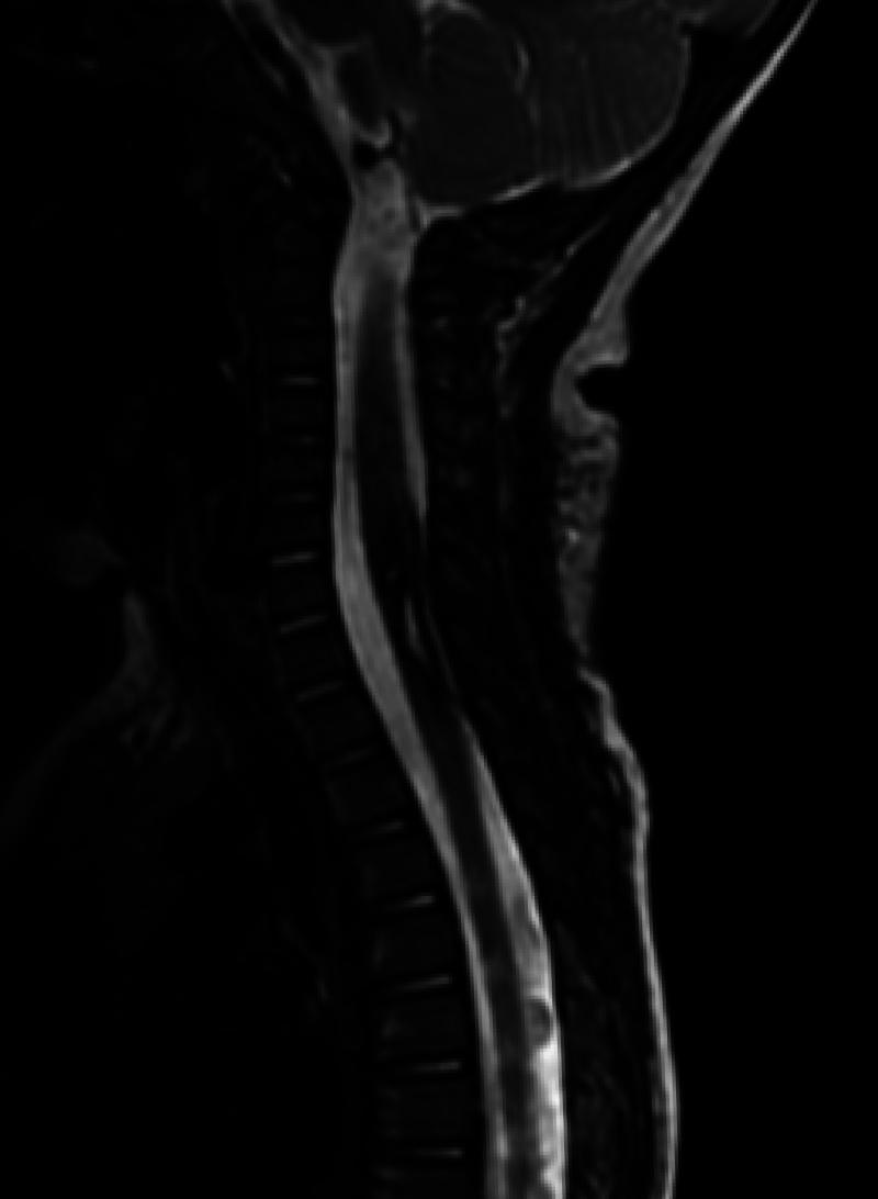 https://cdn.ncbi.nlm.nih.gov/pmc/blobs/30aa/12337979/b0d7c41c1980/CASE2557_figure_2.jpg