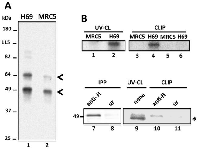 https://cdn.ncbi.nlm.nih.gov/pmc/blobs/30b4/3390395/25a836cc9b4f/pone.0040315.g003.jpg