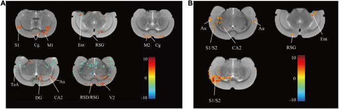 https://cdn.ncbi.nlm.nih.gov/pmc/blobs/30b4/9389218/334fbde03f80/fnins-16-974940-g003.jpg