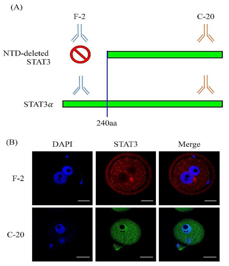https://cdn.ncbi.nlm.nih.gov/pmc/blobs/30b9/7796490/f27d1cc4ac13/ijms-22-00460-g006.jpg