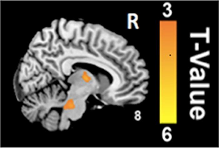 https://cdn.ncbi.nlm.nih.gov/pmc/blobs/30ba/5605002/9cfe6f73a567/pone.0184896.g002.jpg