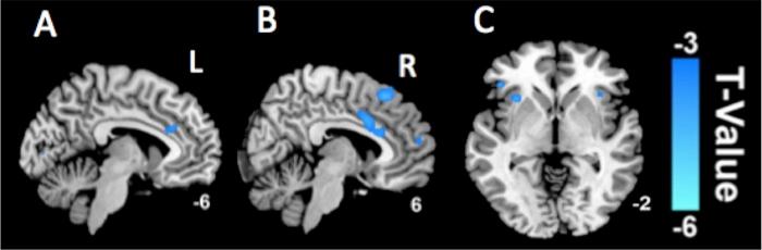 https://cdn.ncbi.nlm.nih.gov/pmc/blobs/30ba/5605002/9d3fe6117edd/pone.0184896.g001.jpg