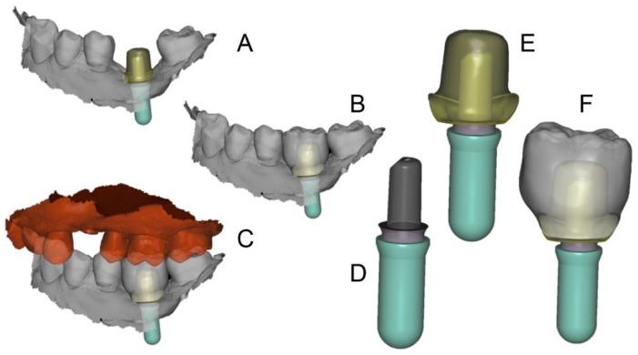 https://cdn.ncbi.nlm.nih.gov/pmc/blobs/30be/6388107/233ff2c58cee/ijerph-16-00317-g003.jpg
