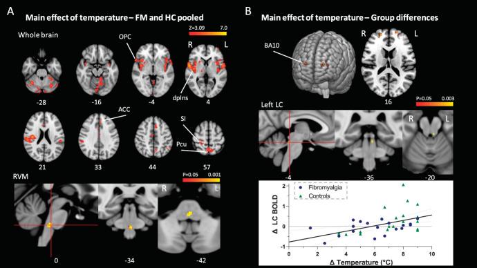 https://cdn.ncbi.nlm.nih.gov/pmc/blobs/30c5/8675057/3038d104d15c/jop-163-0125-g004.jpg