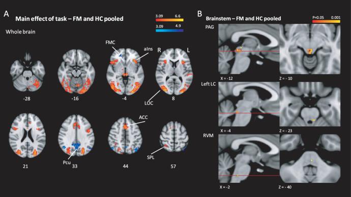 https://cdn.ncbi.nlm.nih.gov/pmc/blobs/30c5/8675057/c930162f32aa/jop-163-0125-g005.jpg