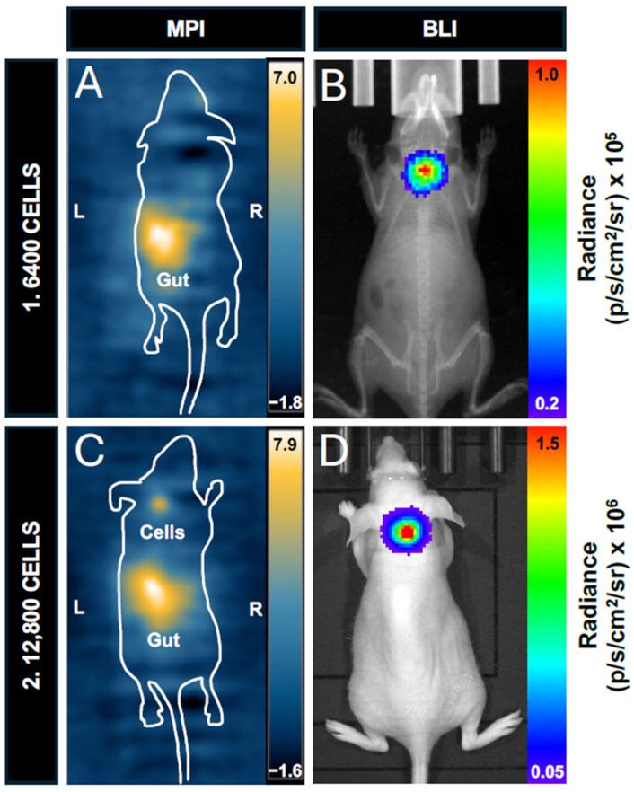 https://cdn.ncbi.nlm.nih.gov/pmc/blobs/30c9/11598277/e3bd8964da7e/tomography-10-00135-g006.jpg