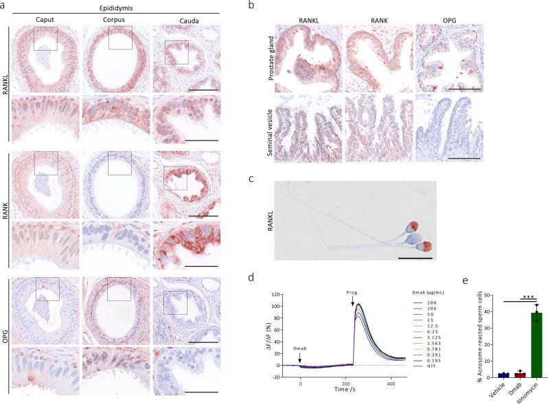 https://cdn.ncbi.nlm.nih.gov/pmc/blobs/30cb/8065035/70f715f53214/41467_2021_22734_Fig4_HTML.jpg