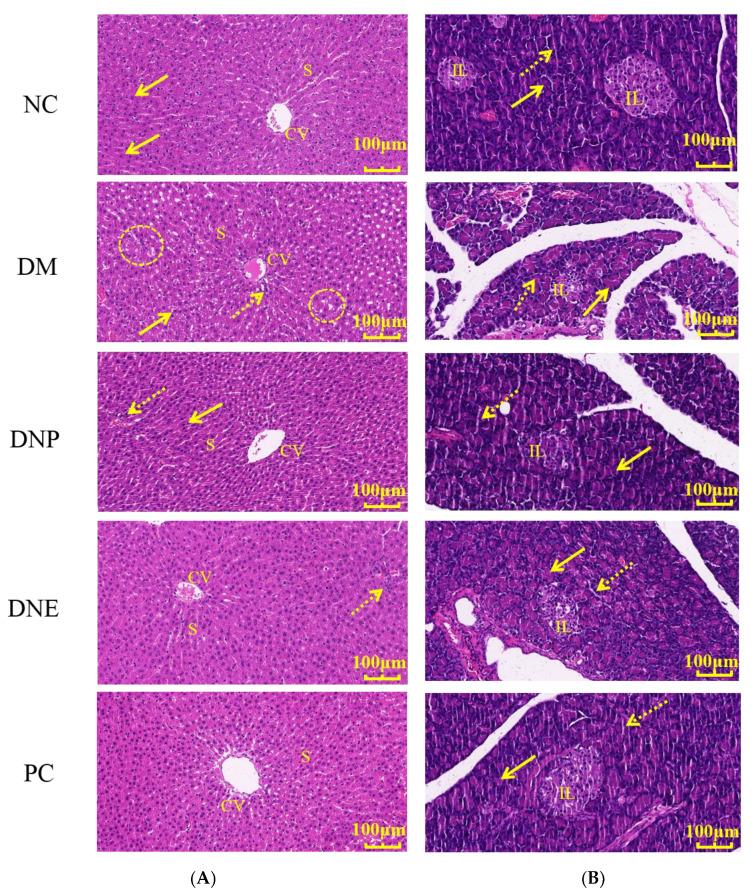 https://cdn.ncbi.nlm.nih.gov/pmc/blobs/30cc/10057382/2f2f76f111b0/molecules-28-02683-g014.jpg