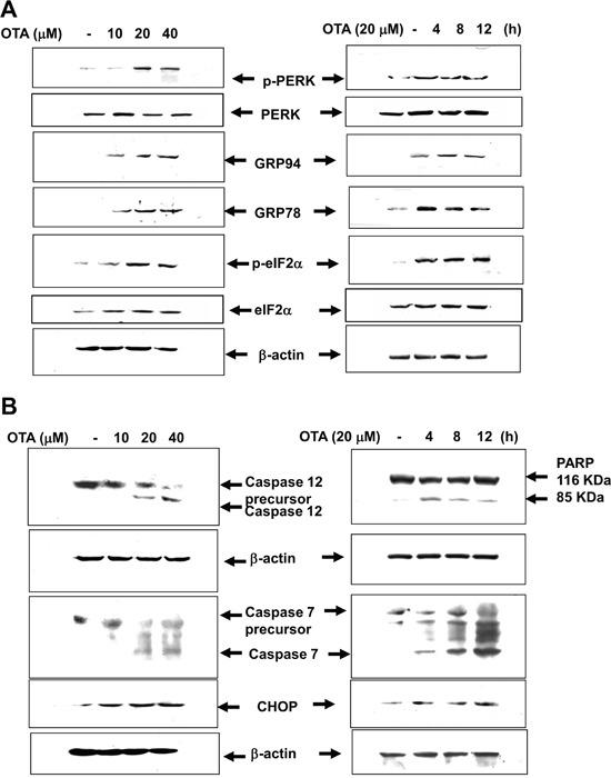https://cdn.ncbi.nlm.nih.gov/pmc/blobs/30d0/5386691/1f31c3221473/oncotarget-08-19376-g002.jpg