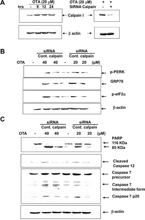 https://cdn.ncbi.nlm.nih.gov/pmc/blobs/30d0/5386691/6c00f85e3e33/oncotarget-08-19376-g007.jpg