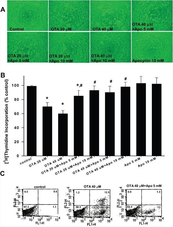 https://cdn.ncbi.nlm.nih.gov/pmc/blobs/30d0/5386691/dc34efa493cd/oncotarget-08-19376-g005.jpg