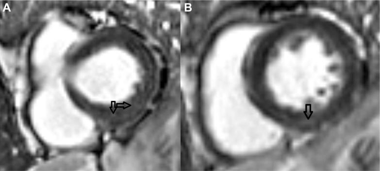 https://cdn.ncbi.nlm.nih.gov/pmc/blobs/30d5/12245416/b4cd8a3ca22a/gr3.jpg