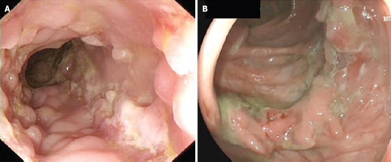 https://cdn.ncbi.nlm.nih.gov/pmc/blobs/30d6/11238685/e9f9913208ae/WJCC-12-5283-g001.jpg