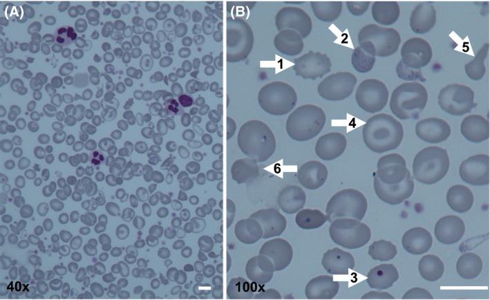 https://cdn.ncbi.nlm.nih.gov/pmc/blobs/30e4/6519365/416889daef31/BJH-185-436-g002.jpg