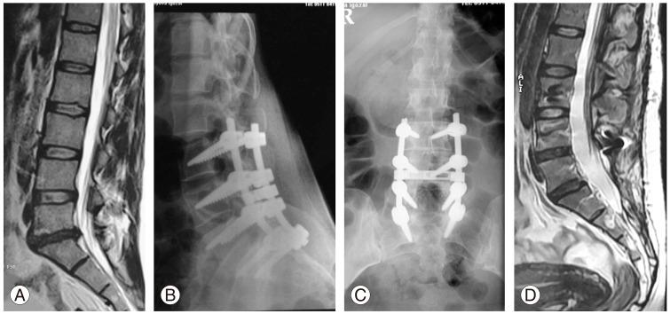 https://cdn.ncbi.nlm.nih.gov/pmc/blobs/30e8/5081335/34ce41c3f09d/asj-10-955-g006.jpg