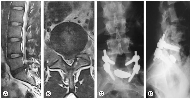https://cdn.ncbi.nlm.nih.gov/pmc/blobs/30e8/5081335/461d3ccc3103/asj-10-955-g005.jpg