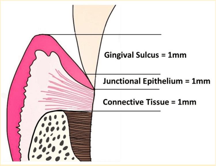 https://cdn.ncbi.nlm.nih.gov/pmc/blobs/30ec/11089581/9345978bdbbf/cureus-0016-00000058128-i03.jpg