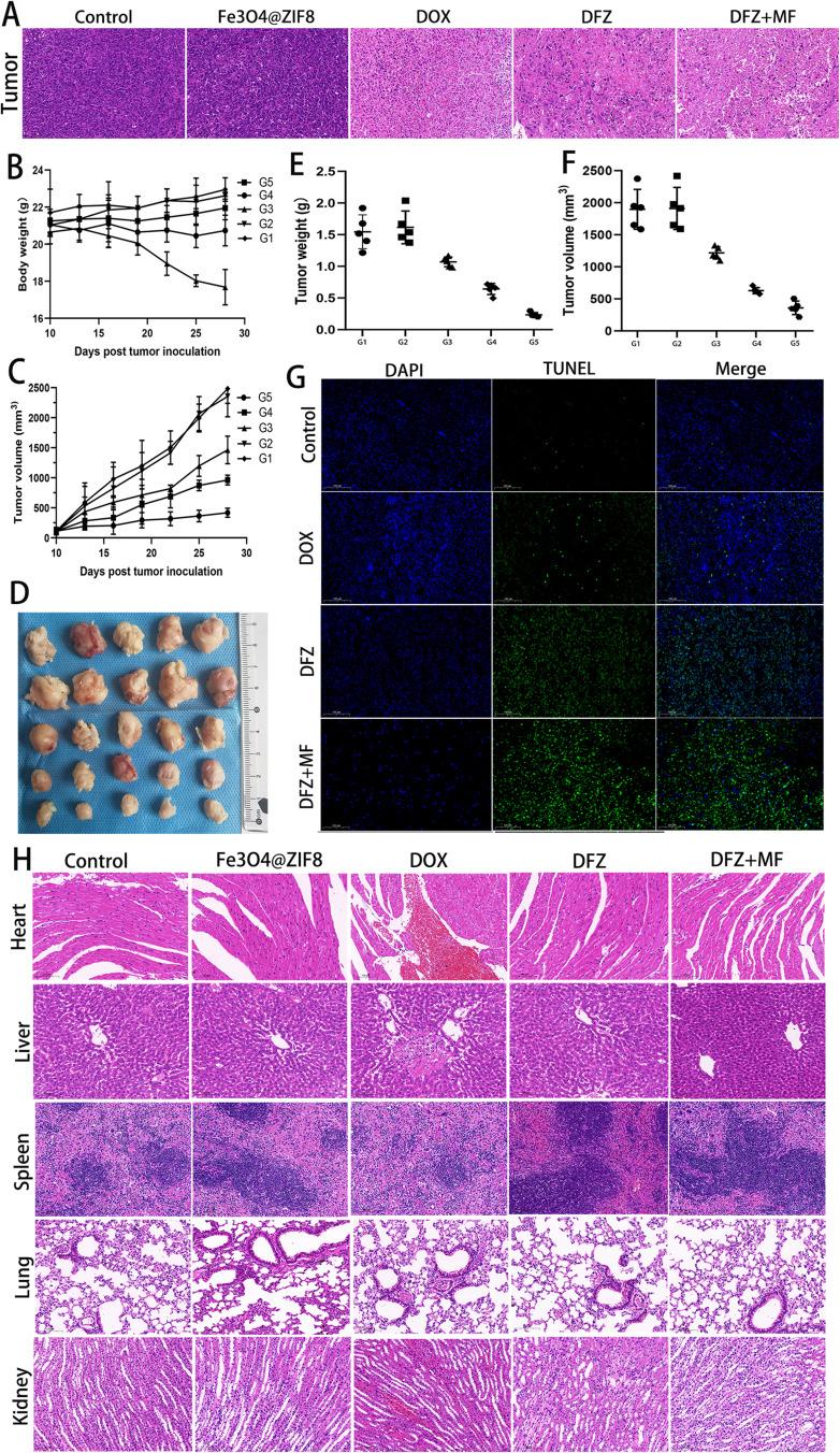 https://cdn.ncbi.nlm.nih.gov/pmc/blobs/30ed/10758197/ac69b2e8c252/IJN-18-7985-g0005.jpg