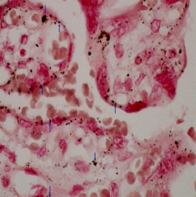 https://cdn.ncbi.nlm.nih.gov/pmc/blobs/30ef/7061448/a8ce8e0b44da/ITX-12-1-g001.jpg