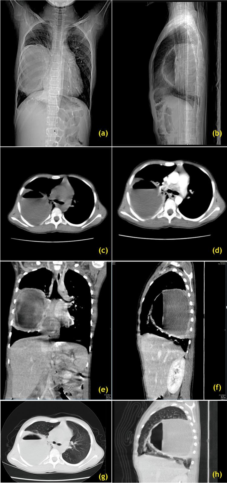 https://cdn.ncbi.nlm.nih.gov/pmc/blobs/30f6/11218490/30d2a2a3783f/cureus-0016-00000063579-i03.jpg