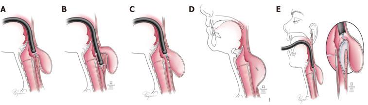 https://cdn.ncbi.nlm.nih.gov/pmc/blobs/30fa/7739143/f041772b6da1/WJGE-12-521-g003.jpg