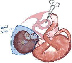 https://cdn.ncbi.nlm.nih.gov/pmc/blobs/3101/10528769/fba7057ed9aa/IBRA-9-183-g001.jpg