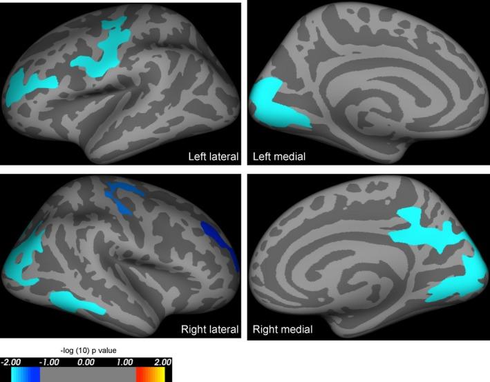 https://cdn.ncbi.nlm.nih.gov/pmc/blobs/3101/4863745/13b0a89329fe/ACN3-3-314-g004.jpg
