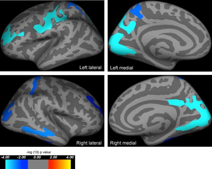 https://cdn.ncbi.nlm.nih.gov/pmc/blobs/3101/4863745/4204aef1bf5b/ACN3-3-314-g001.jpg