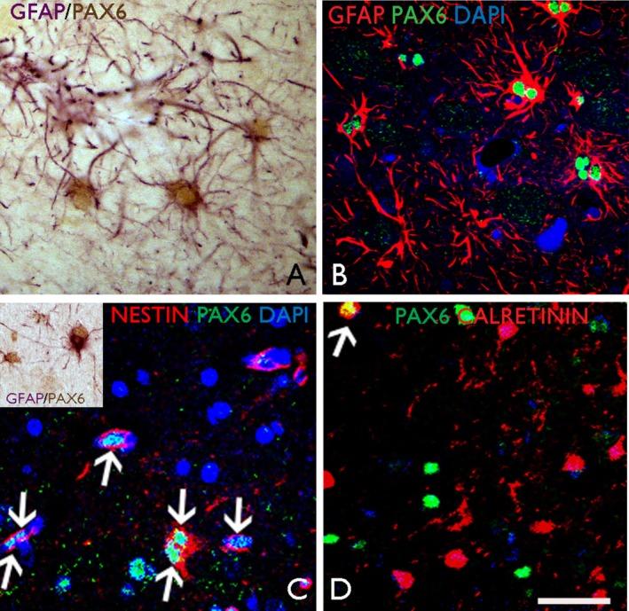 https://cdn.ncbi.nlm.nih.gov/pmc/blobs/3101/4863745/78287c06304a/ACN3-3-314-g007.jpg