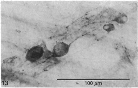https://cdn.ncbi.nlm.nih.gov/pmc/blobs/3112/1257062/22fd92735642/janat00040-0060-a.jpg
