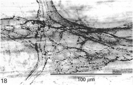 https://cdn.ncbi.nlm.nih.gov/pmc/blobs/3112/1257062/2b00b84d1a95/janat00040-0060-f.jpg
