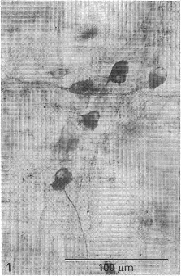 https://cdn.ncbi.nlm.nih.gov/pmc/blobs/3112/1257062/ddd9201c4510/janat00040-0057-a.jpg