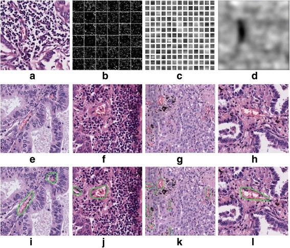 https://cdn.ncbi.nlm.nih.gov/pmc/blobs/3112/5828328/9cb61d0d1e99/12859_2018_2055_Fig6_HTML.jpg