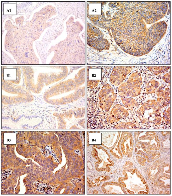https://cdn.ncbi.nlm.nih.gov/pmc/blobs/3112/8750515/0243095bcb36/cancers-14-00212-g0A2.jpg