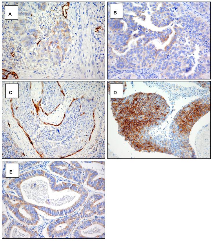 https://cdn.ncbi.nlm.nih.gov/pmc/blobs/3112/8750515/67c4a9acd49e/cancers-14-00212-g0A3.jpg