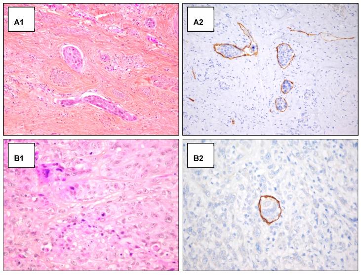 https://cdn.ncbi.nlm.nih.gov/pmc/blobs/3112/8750515/6879804b8fd7/cancers-14-00212-g0A1.jpg