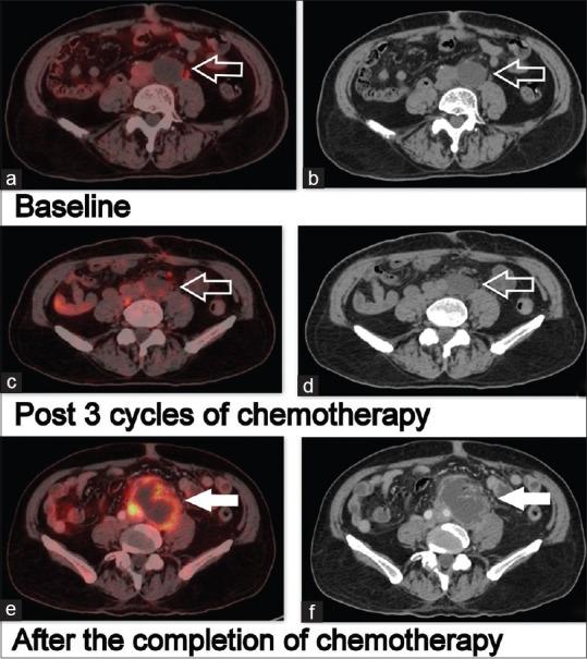 https://cdn.ncbi.nlm.nih.gov/pmc/blobs/3113/8130696/906b626fa1f6/IJNM-36-73-g002.jpg