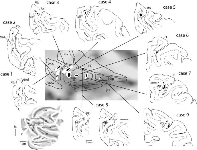 https://cdn.ncbi.nlm.nih.gov/pmc/blobs/311b/5779118/cd01d65bb96c/enu0061724680003.jpg