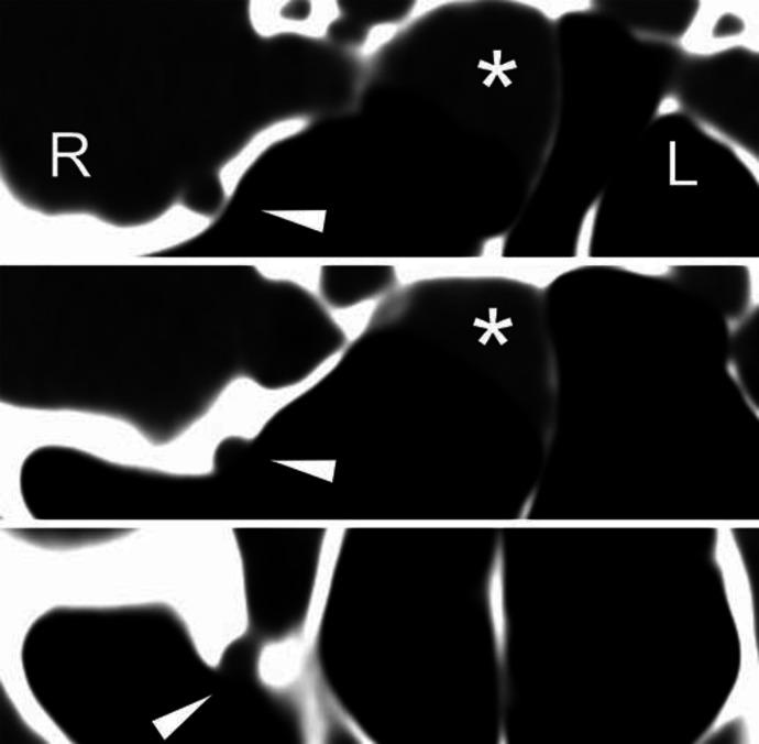 https://cdn.ncbi.nlm.nih.gov/pmc/blobs/311c/7989944/a2632f03981c/crn-0013-0171-g04.jpg