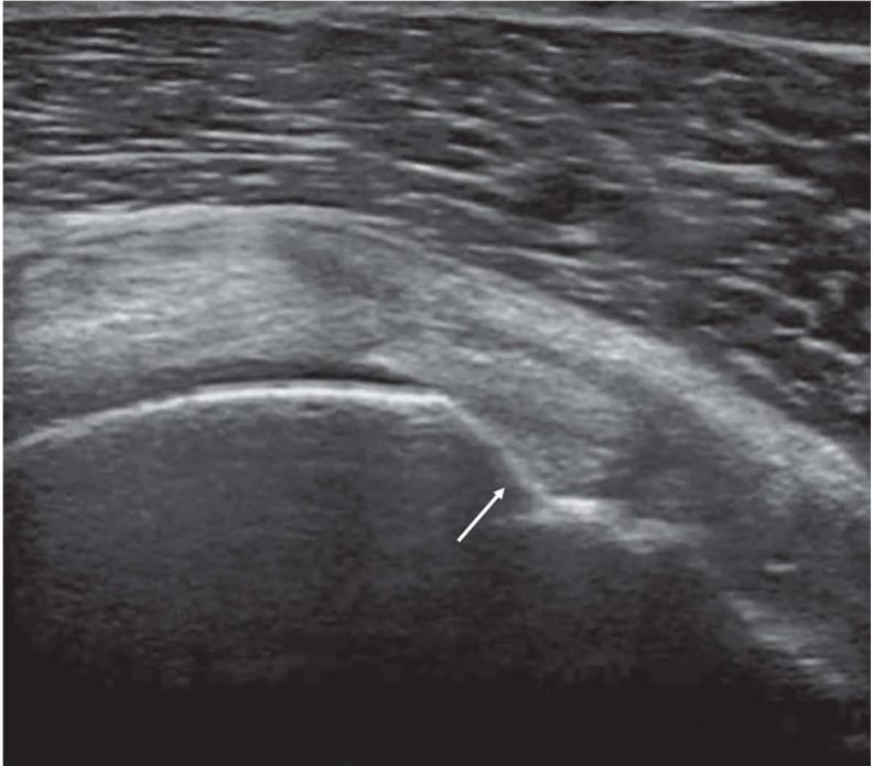 https://cdn.ncbi.nlm.nih.gov/pmc/blobs/3121/6625571/04921a67a864/ACTA-90-84-g005.jpg