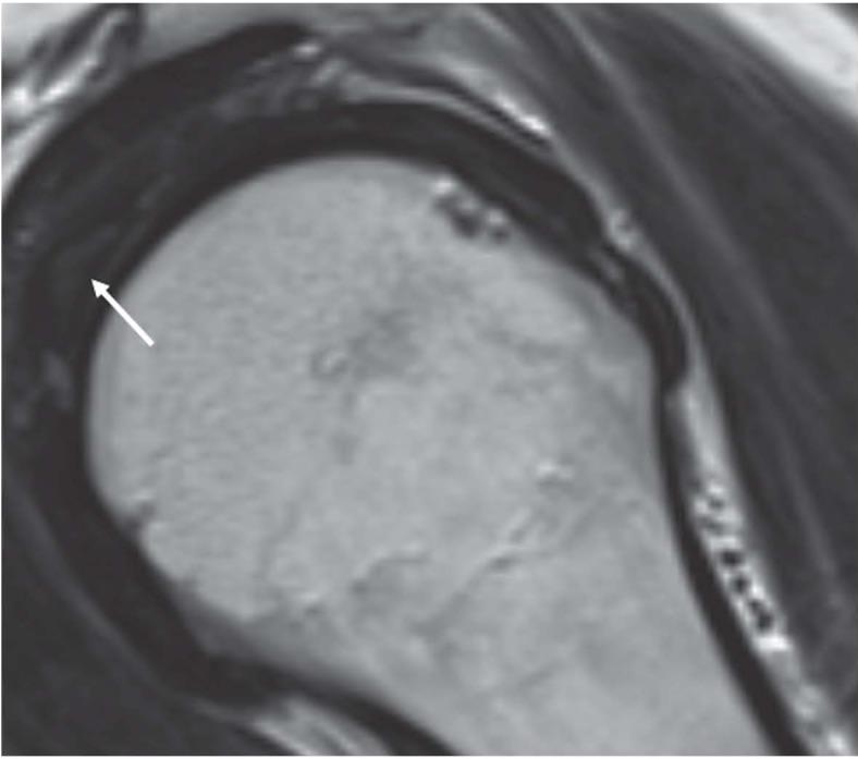 https://cdn.ncbi.nlm.nih.gov/pmc/blobs/3121/6625571/0cadc92d6f1a/ACTA-90-84-g014.jpg