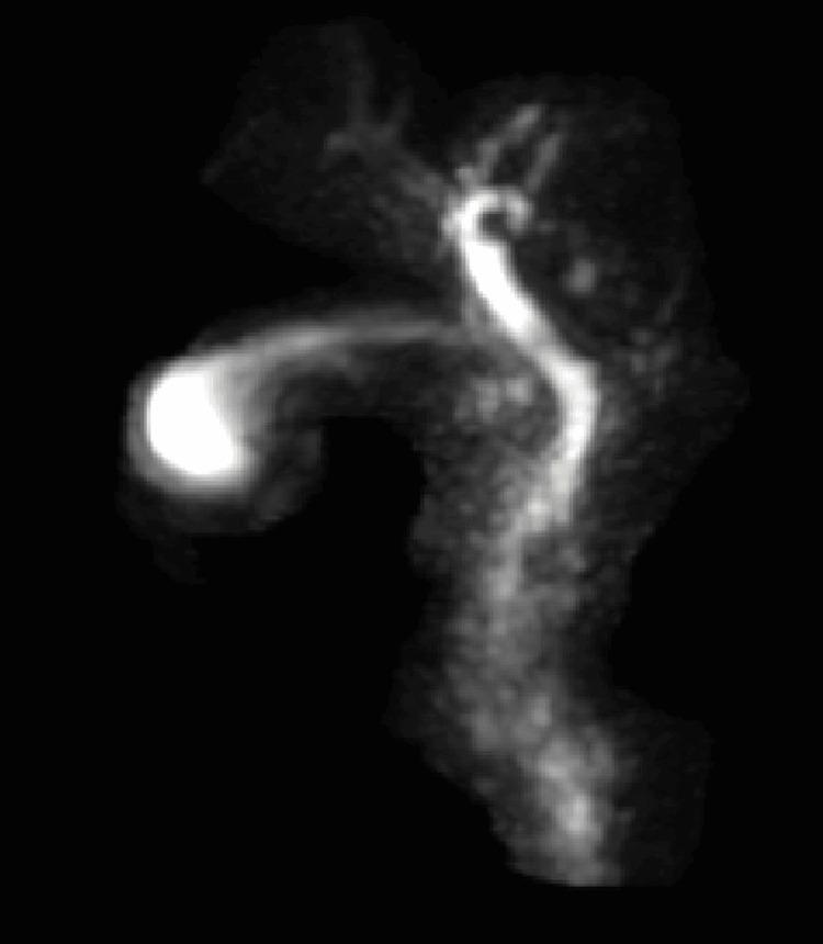https://cdn.ncbi.nlm.nih.gov/pmc/blobs/3129/12168721/2024d30f390d/cureus-0017-00000084253-i02.jpg