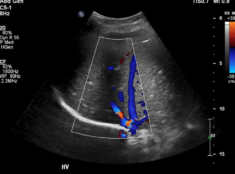 https://cdn.ncbi.nlm.nih.gov/pmc/blobs/3129/12168721/229a5d1f546a/cureus-0017-00000084253-i01.jpg
