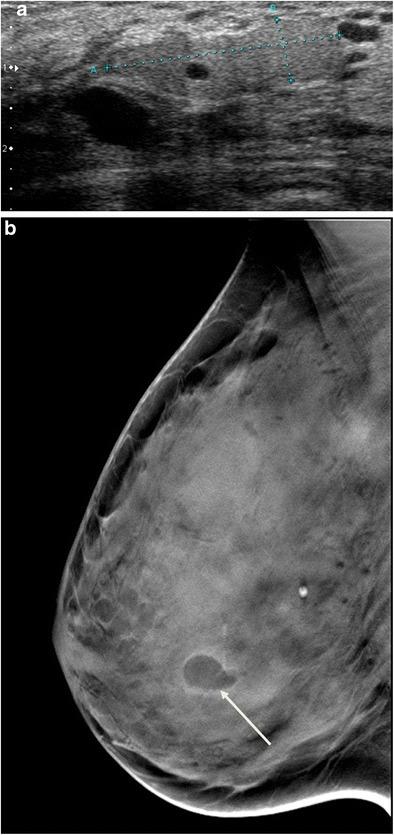 https://cdn.ncbi.nlm.nih.gov/pmc/blobs/312c/5893486/423c89854642/13244_2017_590_Fig8_HTML.jpg