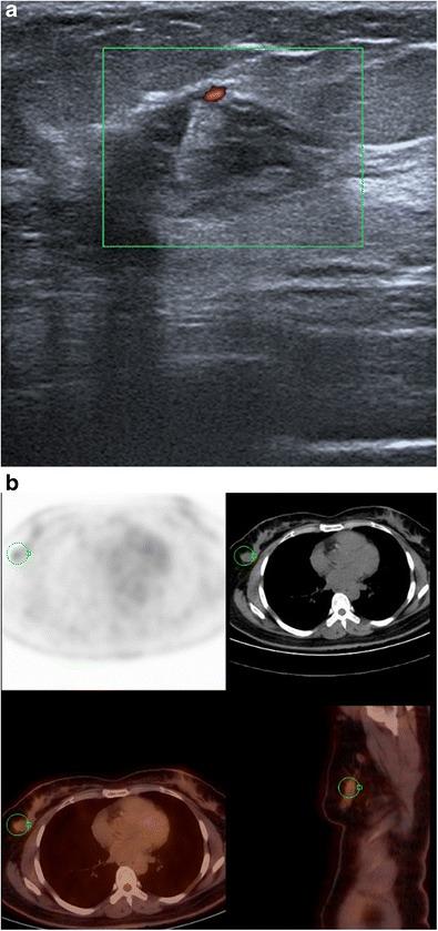 https://cdn.ncbi.nlm.nih.gov/pmc/blobs/312c/5893486/ec2c10990aca/13244_2017_590_Fig19_HTML.jpg