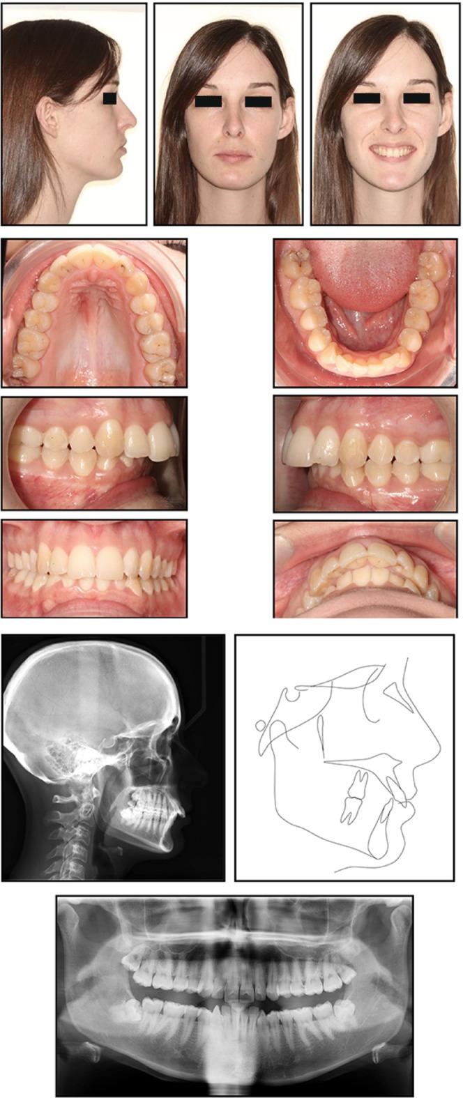 https://cdn.ncbi.nlm.nih.gov/pmc/blobs/312f/9860201/1064dded7906/CCR3-11-e6854-g004.jpg